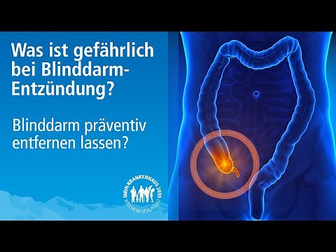 Blinddarmentzündung erkennen | Anzeichen einer gefährlichen Appendizitis|Blinddarm OP erforderlich?