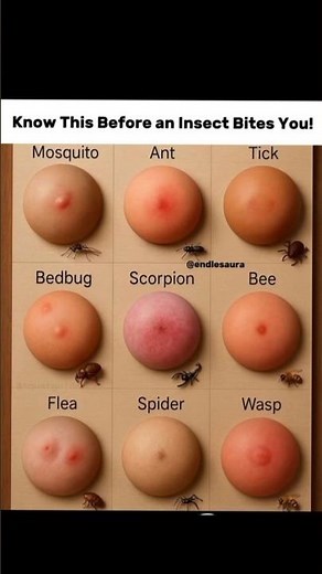 Bug Bite Identification You Should Know 😳