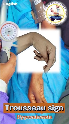 Trousseau's Sign: The Blood Pressure Cuff Trick #TrousseausSign #Hypocalcemia #meded #english