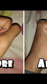 Xiaomi tutorial cara merubah flash kuning menjadi putih (Xiaomi redmi note 4x)