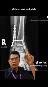 drcheeorthopaedic on TikTok