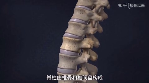 l45l5s1椎间盘轻度向后突出怎么办？教你腰椎l5s1突出矫正方法