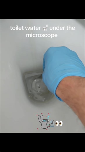 toilet water 💧 🚽 🔬 #creatorsearchinsight2026 #microscope #현미경 #science #fup