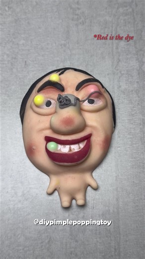 Satisfying Pimple Popping Compilation | ASMR Experience