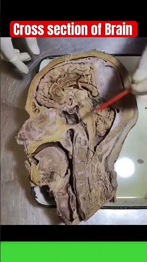 🧠 Real Human Brain Cross-Section | Fascinating Anatomy Up Close!