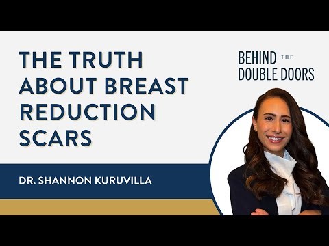 The Truth About Breast Reduction Scars