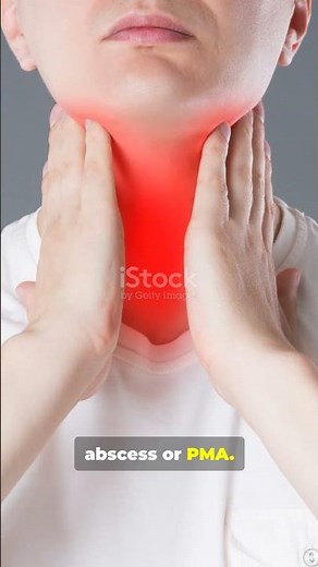 Rare Neck Abscesses EXPLAINED in 45 Seconds!