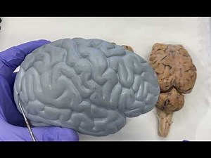 Gyri, Sulci, Cerebral Lobes, Cerebellum, & White/Gray Matter | Sheep Brain