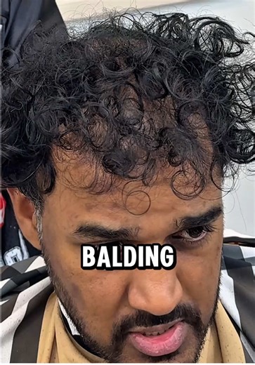 13465 Inwood Rd 185 Dallas, TX 75244 📍 My client came to Dallas to fix his balding curls so I hooked him up with a curly hair trim a low taper 🔥 #dallasbarber #curls #balding #curlyhair #modernmullet