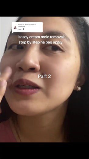 Step-by-Step Guide: Using Kasoy Cream for Mole Removal