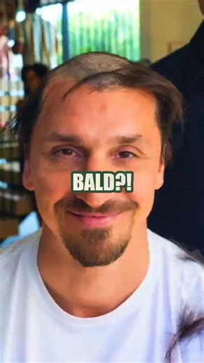 Zlatan Went Bald?! 💀 Here’s What Actually Happened…