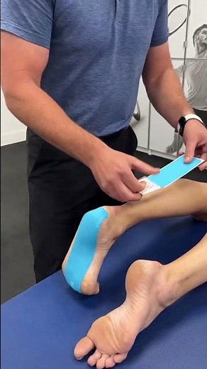 Taping For Plantar Fasciitis.