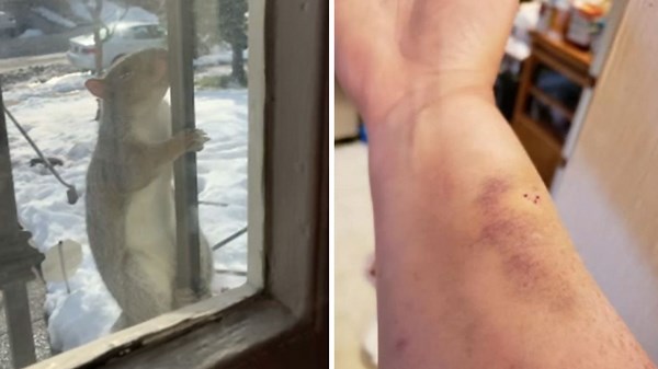 Aggressive squirrel attacks reported in Queens neighborhood