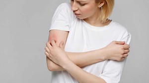 The 10 Common Skin Rashes and How to Get Rid of Them - Health Makes You