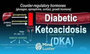 Mind Luster - Learn Diabetic Ketoacidosis DKA Pathophysiology Animation