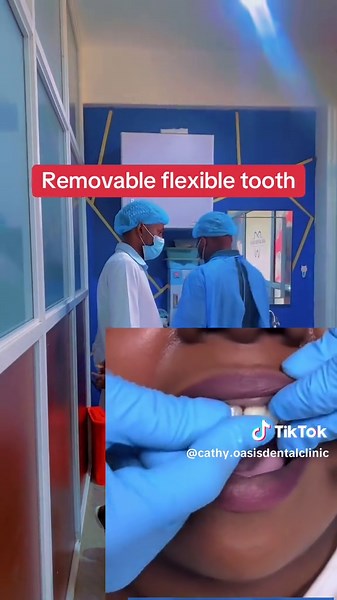 Permanent Teeth Replacement Options in Uganda