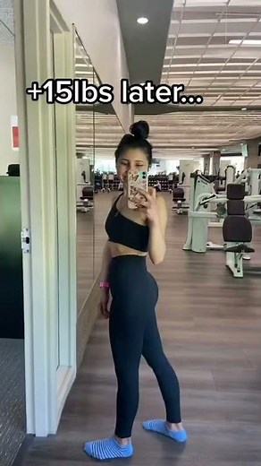 Weight gain transformation in anorexia recovery :)