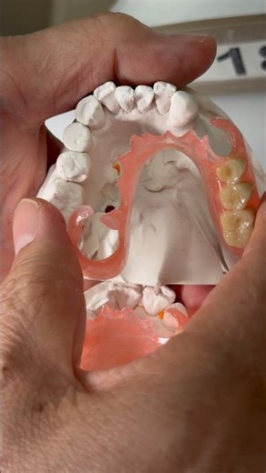 FiberFlex partials for Dr. John Vargas in New York