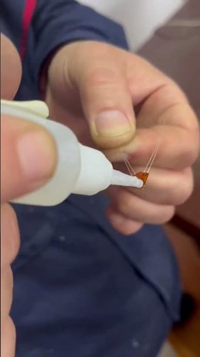 Metal stress detector metal residual stress detector