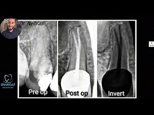 X-ray In Dentistry || How to read and take dental x ray || Dr/ Nebras