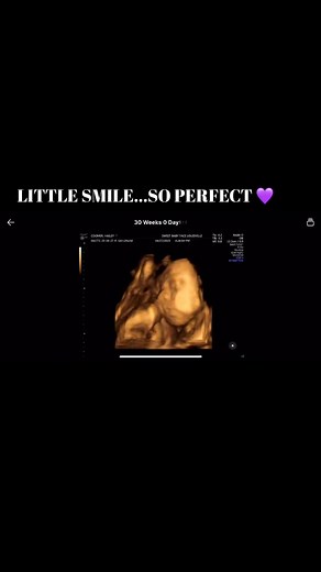 LOOK AT HER PERFECT SMILE! | Michelle Coomer