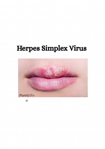 HERPES SIMPLEX VIRUS Cold sore? Genital outbreak? That’s herpes,a common virus passed through simple closeness. All genders, All ages, All backgrounds. Let’s replace stigma with understanding. 🌿 Herpes is something many people quietly live with, people of every gender, background, and lifestyle. It’s one of the most common viruses on the planet, usually passed through everyday closeness like kissing or intimacy. For some, it shows up as cold sores or occasional outbreaks. For many others, it ne