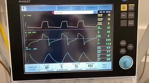 10K views · 563 reactions | Ventilator Crash Course. | ICU Critical Care Nurses | Facebook