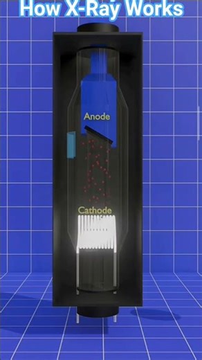 How X- Ray Machine Works🤔🤔😱#shorts #viral #shortvideos #facts
