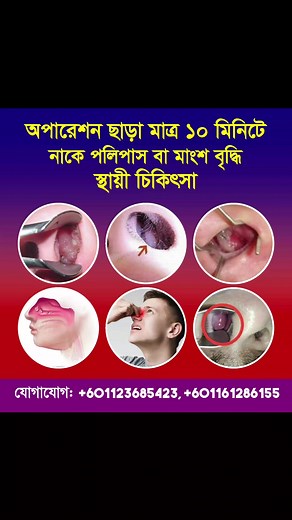 মালয়েশিয়াতে হোমিও চিকিৎসা on Reels | Facebook