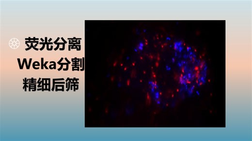 荧光RGB图自动拆分｜Weka机器学习   阈值后处理精准定量教学