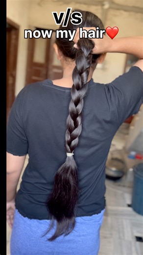 hair growth journey 📈DIY hair growth secret remedy 👀✅#haorc #hairgrowth #haircare #longhair