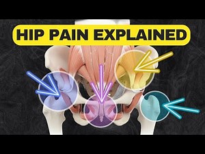 Why Your Hip Hurts (What Each Pain Location Means)