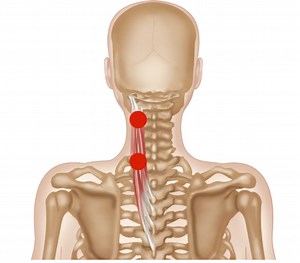 Splenius Muscles | Trigger Point Release
