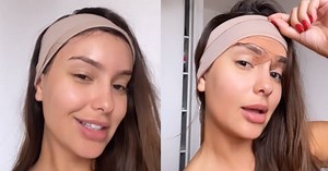 Thaís Braz mostra resultado da cirurgia para diminuir testa