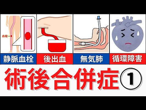 【20分で解説、45分で国試問題解説】術後2日目までに起こる術後合併症
