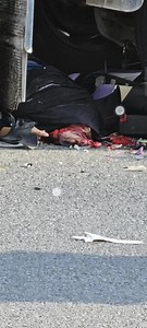 Chinese man's head smashed