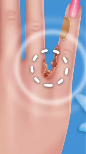 Ouch! 🫣 #finger #heal #mobilegame #asmr #satisfying #game | ASMR Playzone