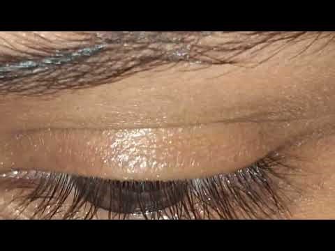 HUMAN EYE | FULL CHAPTER EXPLANATION | FOR CLASS 8TH AND 10TH