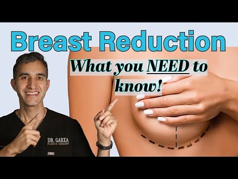Breast Reduction Surgery: Everything you Need to Know
