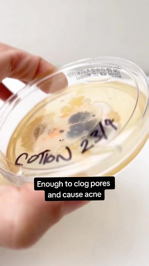 Magic in Each Pillowcase: Silk vs Satin for Acne Treatment