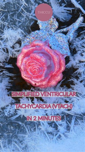 @theicudoctor1 on Instagram: "VTACH made simple! Straight from the THICCU Pocket notes #ccu #cardiology #cardiologist #cvicu #icunurse #icunurses #criticalcaremedicine #internalmedicineresidency #internalmedicine"
