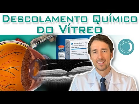 Descolar o vítreo antes da vitrectomia pode ajudar na cirurgia?