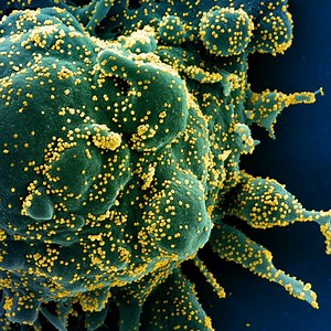 26K views · 653 reactions | Want to know more about the #COVID19 Delta Plus variant❓ Learn more about the #coronavirus variants: https://bit.ly/2URUplH | World Health Organization Western Pacific Region | Facebook