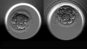 Blastocyst formation time lapse under microscope.