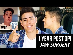 1 YEAR POST OP! DOUBLE JAW SURGERY *BEFORE & AFTER FOOTAGE* | JAIRWOO