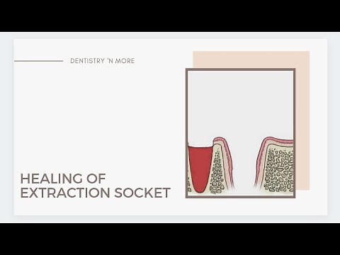 HEALING OF EXTRACTION WOUND