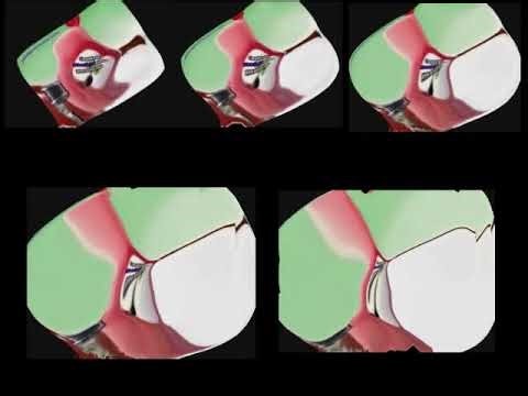 5 Fatter KlaskyKlaskyKlaskyKlasky Gummy Bear Song Version's (FIXED)