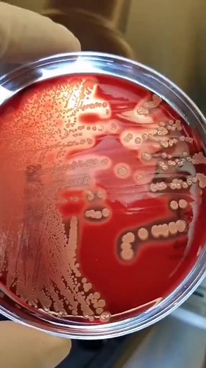 64K views · 1.8K reactions | Microbiology: Isolation and identification of staphylococcus spp❤️❤️. #lablife #Microbiology #bacteria | Lab life | Facebook
