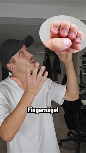 Wer hat solche Fingernägel?👀