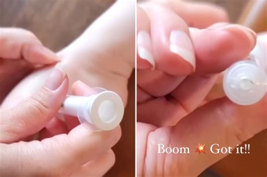 I’m an ER doctor — this is the best, painless way to remove a splinter